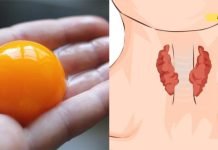 ენდოკრინოლოგი: „ფარისებრი ჯირკვლის პრობლემა გაქვთ? აუცილებლად მიირთვით დღეში მინიმუმ 1 კვერცხის გული.