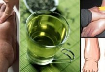 თუ ფეხები ხშირად გიშუპდებათ აი რა უნდა გააკეთოთ! მე მას მივმრთავ როცა კი შევატყობ ფეხებს შეშუპებას..