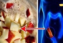 გაასუფთავეთ თქვენი ნაწლავი ტოქსიკური ნარჩენებისგან ვაშლით, თაფლით და სელის თესლით