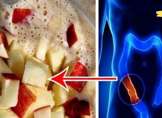 გაასუფთავეთ თქვენი ნაწლავი ტოქსიკური ნარჩენებისგან ვაშლით, თაფლით და სელის თესლით