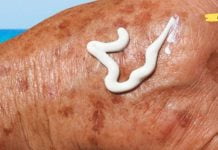 აი, როგორ შეგიძლიათ გამოიყენოთ ნატურალური პროდუქტები ასაკობრივი ლაქების მოსაშორებლად!