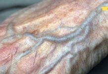 ცუდი ცირკულაცია! ხელები და ფეხები მუდმივად ცივი გაქვთ? აქ მოცემულია რამდენიმე რჩევა ამ პრობლემის მოსაგვარებლად!