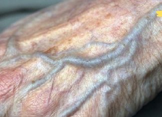 ცუდი ცირკულაცია! ხელები და ფეხები მუდმივად ცივი გაქვთ? აქ მოცემულია რამდენიმე რჩევა ამ პრობლემის მოსაგვარებლად!