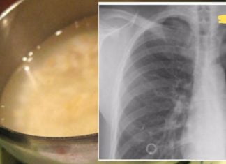 ამ სიროფით გავასუფთავე ფილტვები არასასურველი ნარჩენებისგან! ეს ბევრს გამოგადგებათ..