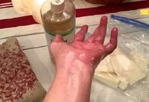 ამ ზეთმა ხელახლა მშობა: “ეს ზეთი სახსარზე წავისვი და დილით გამეღვიძა ყოველგვარი ტკივილის გარეშე – ის ნამდვილად მუშაობს”