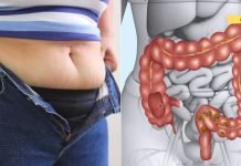 ამ მეთოდით გავიწმინდე ორგანიზმი შლაკებისა და ტოქსინებისგან! მხოლოდ ამ მეთოდით შევძელი სიმსუქნესთან ბრძოლა!