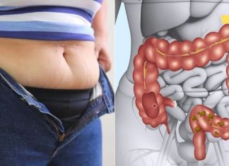 ამ მეთოდით გავიწმინდე ორგანიზმი შლაკებისა და ტოქსინებისგან! მხოლოდ ამ მეთოდით შევძელი სიმსუქნესთან ბრძოლა!