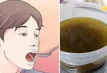 ეფექტი დაუყოვნებლივ: მოიცილეთ ლორწო ყელიდან და ფილტვებიდან ერთი ყლუპის შემდეგ