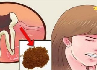 მოიშორეთ კბილის ტკივილი სახლში: „ჩემი სტომატოლოგიც კი გაოცებული იყო ამ მეთოდებით“!