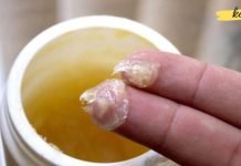 ამ მალამომ უამრავი სიცოცხლე გადაარჩინა! ის მართლაც შეუფასებელია!