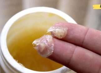 ამ მალამომ უამრავი სიცოცხლე გადაარჩინა! ის მართლაც შეუფასებელია!