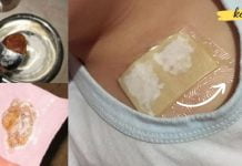 გაიკეთეთ თაფლისა და ჯანჯაფილის კომპრესი- ის კურნავს ძლიერ ხველას და ხსნის ფილტვებს სულ რაღაც ერთ ღამეში!