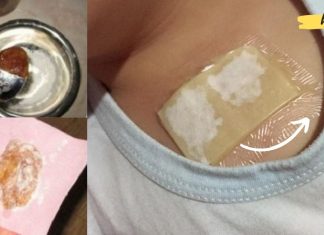 გაიკეთეთ თაფლისა და ჯანჯაფილის კომპრესი- ის კურნავს ძლიერ ხველას და ხსნის ფილტვებს სულ რაღაც ერთ ღამეში!