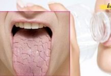 რატომ გვიშრება პირი ღამით და დილით? ექსპერტები ხსნიან პრობლემას და გვთავაზობენ ამის მოგვარების ხერხებს!