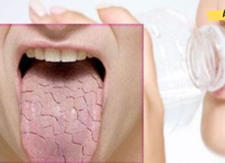 რატომ გვიშრება პირი ღამით და დილით? ექსპერტები ხსნიან პრობლემას და გვთავაზობენ ამის მოგვარების ხერხებს!