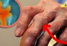 მოიშორეთ ძვლების ტკივილი ამ ბუნებრივი ინგრედიენტის დახმარებით!…