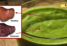 ცხიმოვანი ღვიძლის წმენდა: აღადგინეთ თქვენი მეტაბოლიზმი და გაზარდეთ თქვენი წონის დაკლება