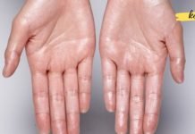 ამ გზით გავუმკლავდი ხშირ ოფლიანობას. ეს უნდა წაიკითხოთ!