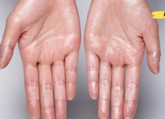 ამ გზით გავუმკლავდი ხშირ ოფლიანობას. ეს უნდა წაიკითხოთ!