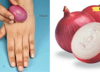 ამ ქალმა ხელზე უმი ხახვი დაიდო და საოცარი შედეგი მიიღო. ეს თქვენც გამოგადგებათ