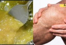 საკმარისია მხოლოდ ორი ინგრედიენტი: ნატურალური საშუალება მტკივნეული და შეშუპებული მუხლებისთვის