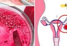 მოიცილეთ კისტა და ფიბროიდები საკვერცხეებზე მხოლოდ ორი ინგრედიენტისგან შემდგარი სასმელის დახმარებით