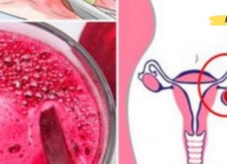 მოიცილეთ კისტა და ფიბროიდები საკვერცხეებზე მხოლოდ ორი ინგრედიენტისგან შემდგარი სასმელის დახმარებით