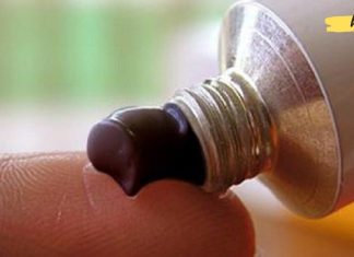 გამოიყენეთ ვიშნევსკის მალამო ბუასილის სამკურნალდ!