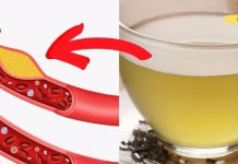 აი როგორ უნდა დავწიოთ ქოლესტერინის დონე სახლის პირობებში! ეფექტი გარანტირებულია..