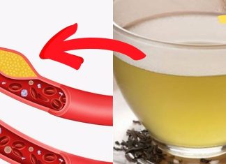 აი როგორ უნდა დავწიოთ ქოლესტერინის დონე სახლის პირობებში! ეფექტი გარანტირებულია..