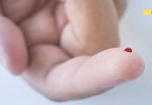 ჩემს მეგობარს გენეტიკურად აქვს სქელი სისხლი. ამიტომ მუდმივად იყენებს ამ საშუალებებს თრომბოზის თავიდან ასაცილებლად..