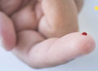 ჩემს მეგობარს გენეტიკურად აქვს სქელი სისხლი. ამიტომ მუდმივად იყენებს ამ საშუალებებს თრომბოზის თავიდან ასაცილებლად..