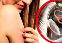 თუ ეს ნიშნები გაქვთ, ე.ი. თქვენს ორგანიზმში პარაზიტები ბუდობენ! დროულად მოახდინეთ მათი გამოდევნა!