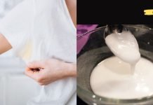 როგორ მოვაშოროთ ოფლის ყვითელი ლაქები პერანგიდან? სასარგებლო რჩევები..