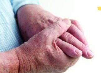 ეს ხალხური რეცეპტები დაგეხმარებათ ართრიტთან ბრძოლაში! სადეთ და არ ინანებთ..