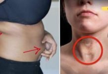 მე ყურადღებას არ ვაქცევდი ამ სიმპტომებს, რამაც ძალიან ცუდ შედეგამდე მიმიყვანა.. გაეცანით მას, რომ თქვენც ჩემს მდგომარეობაში არ აღმოჩნდეთ..