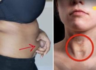 მე ყურადღებას არ ვაქცევდი ამ სიმპტომებს, რამაც ძალიან ცუდ შედეგამდე მიმიყვანა.. გაეცანით მას, რომ თქვენც ჩემს მდგომარეობაში არ აღმოჩნდეთ..