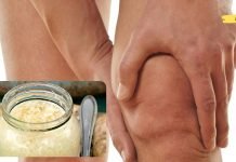 სახსრების ტკივილის და შეშუპების დროს მიიღეთ პირშუშხას ნაყენი. მისი ეფექტიურობა დადასტურებულია..