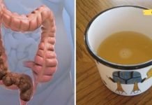 ამ გზით შეძლებთ მსხვილი ნაწლავის გაწმენდას. გაათავისუფლეთ ორგანიზმი ზედმეტი ნარჩენებისგან..