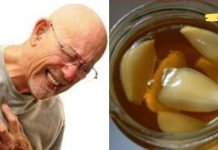 გამოიყენეთ ეს ძლიერი ნაზავი არტერიების გასაწმენდად და გულის შეტევის თავიდან ასაცილებლად. Ძალიან სასარგებლოა!