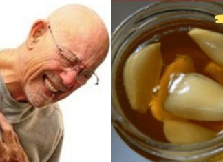 გამოიყენეთ ეს ძლიერი ნაზავი არტერიების გასაწმენდად და გულის შეტევის თავიდან ასაცილებლად. Ძალიან სასარგებლოა!