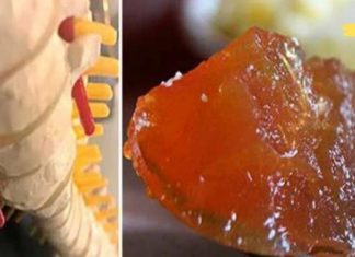 გამოიყენეთ ეს საშუალება ხერხემლის, მუხლის და სახსრების ტკივილის სამკურნალოდ. ამის მეშვეობით ტკივილი აღარ შეგაწუხებთ..