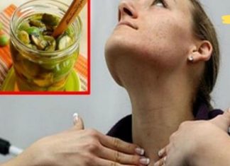 იოდის დეფიციტის გამო ფარისებრი ჯირკვლის პრობლემების შემექმნა. შემდეგ ეს გამოვიყენე და ყველაფერი ნორმაში ჩადგა..