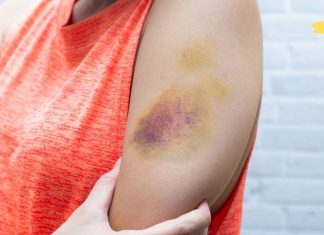 ყურადებით წაიკითხეთ! ეს სიმპტომები ლეიკემიას ახასიათებს,რომლებსაც ყურადღებას არ ვაქცევთ! არ უგულებელყოთ!