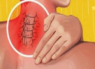 გამოიყენეთ ეს 6 მარტივი ვარჯიში, რომელიც სწრაფად მოგიხსნით კისრის ტკივილს! შედეგი გაგაოცებთ!