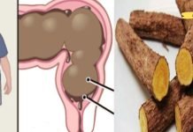 ეს ძალიან სწრაფად მოგიხსნით შებერილობას და გაწმენდს მსხვილ ნაწლავს. გამოცდილი მეთოდია!