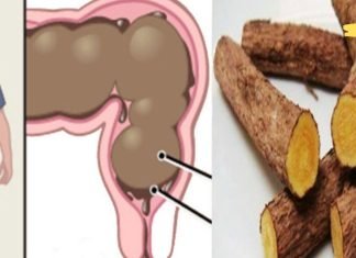 ეს ძალიან სწრაფად მოგიხსნით შებერილობას და გაწმენდს მსხვილ ნაწლავს. გამოცდილი მეთოდია!