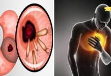 როგორ ავიცილოთ ბაქტერიები, რომლებიც იწვევენ გულძმარვას, შებერილობას და სხვა პრობლემებს. ვერასდროს ვიფიქრებდი. ეს უნდა იცოდე!