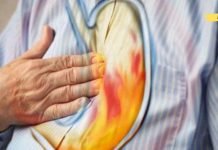 ეს 7 საკვები იწვევს მჟავას რეფლუქსს.. თუ თქვენ გაწუხებთ წვის შეგრძნება ყელში და პირში, უნდა მოერიდოთ მათ მიღებას!