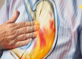 ეს 7 საკვები იწვევს მჟავას რეფლუქსს.. თუ თქვენ გაწუხებთ წვის შეგრძნება ყელში და პირში, უნდა მოერიდოთ მათ მიღებას!